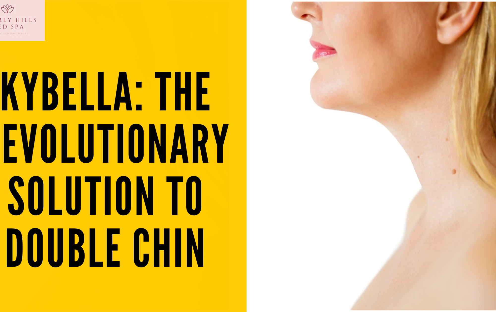 Kybella: The Revolutionary Solution to Double Chin
